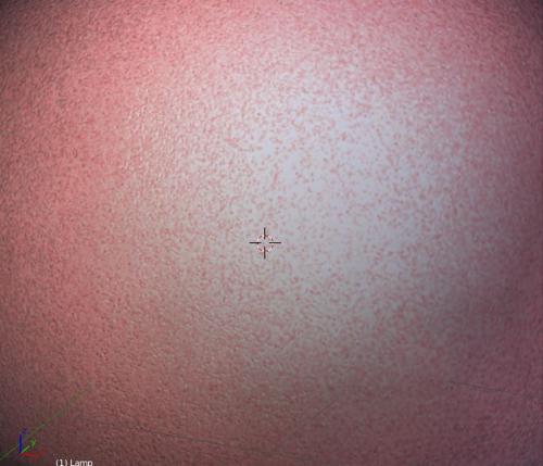 Human Skin