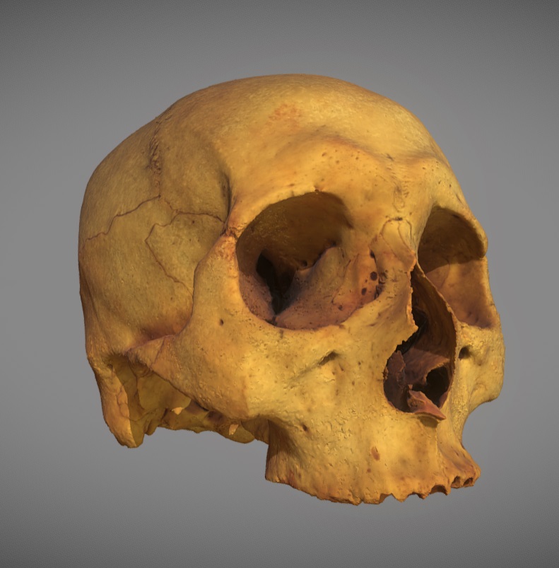 Human skull